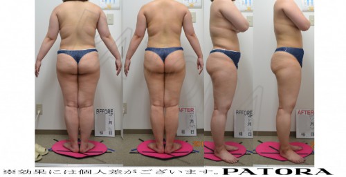 blog2