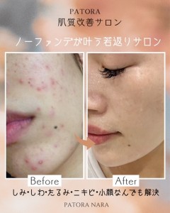 白　オレンジ　シンプル　ビフォーアフター　Instagramの投稿　縦長 - 1