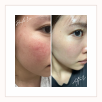 Ivory Minimalist Before and After Skincare Beauty Instagram Post
