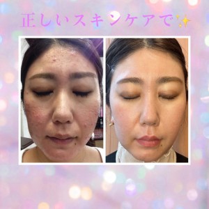 A96EF7FE-D6CC-4623-A4E2-330C3CC4870A