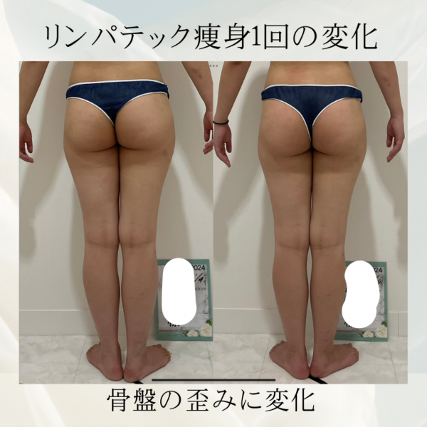 リンパテック痩身1回の変化.zip - 2