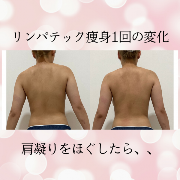 リンパテック痩身1回の変化.zip - 1